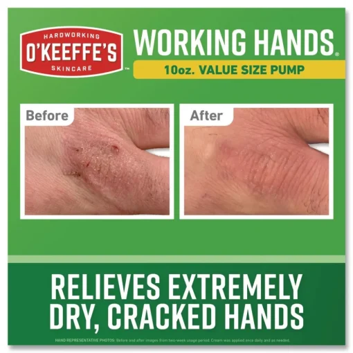 Sale 10 oz Working Hands Hand Cream (2/Carton) Skin Care & Personal Hygiene